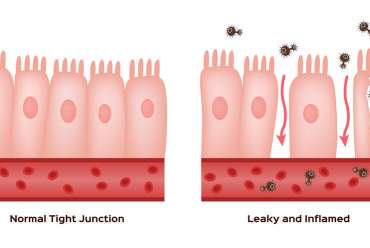 Leaky Gut Explained