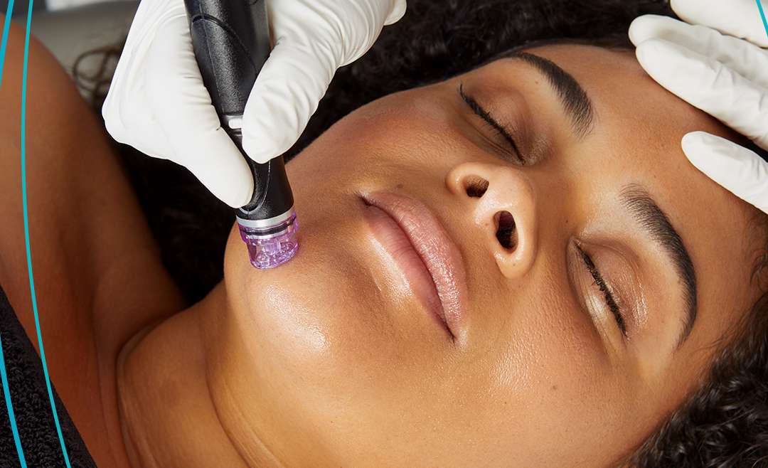 What is a Hydrafacial?